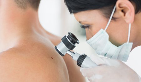 Dermoscopy-Diagnostic Services