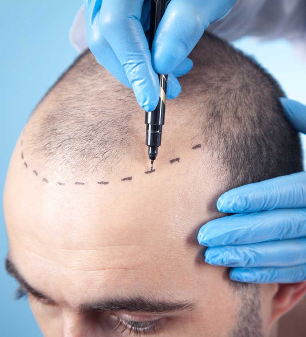 Trichology, the hair treatment-Skin Care Services